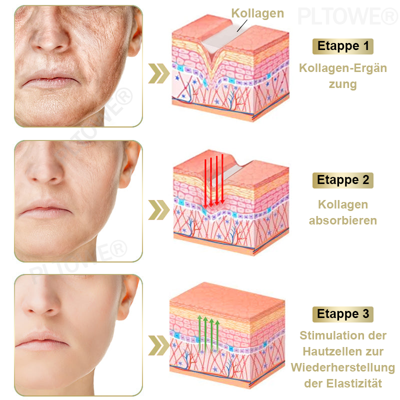 Nur 5 Gläser! Sichern Sie sich jetzt einen exklusiven Rabatt von 50%! Halten Sie Ihre Haut in nur 1 bis 4 Wochen jugendlich und strahlend.  Handeln Sie schnell! 180 Tage Geld-zurück-Garantie!