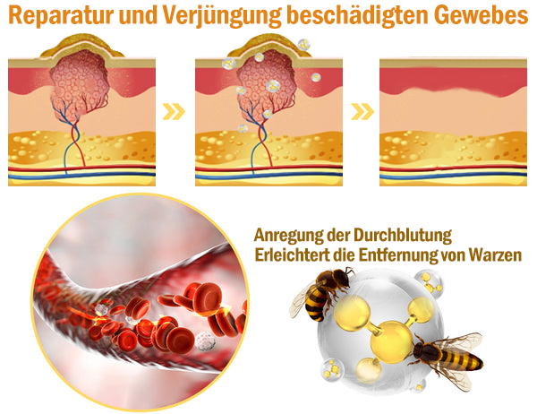 Nur 5 Gläser! Sichern Sie sich jetzt einen exklusiven Rabatt von 50%! Halten Sie Ihre Haut in nur 1 bis 4 Wochen jugendlich und strahlend.  Handeln Sie schnell! 180 Tage Geld-zurück-Garantie!